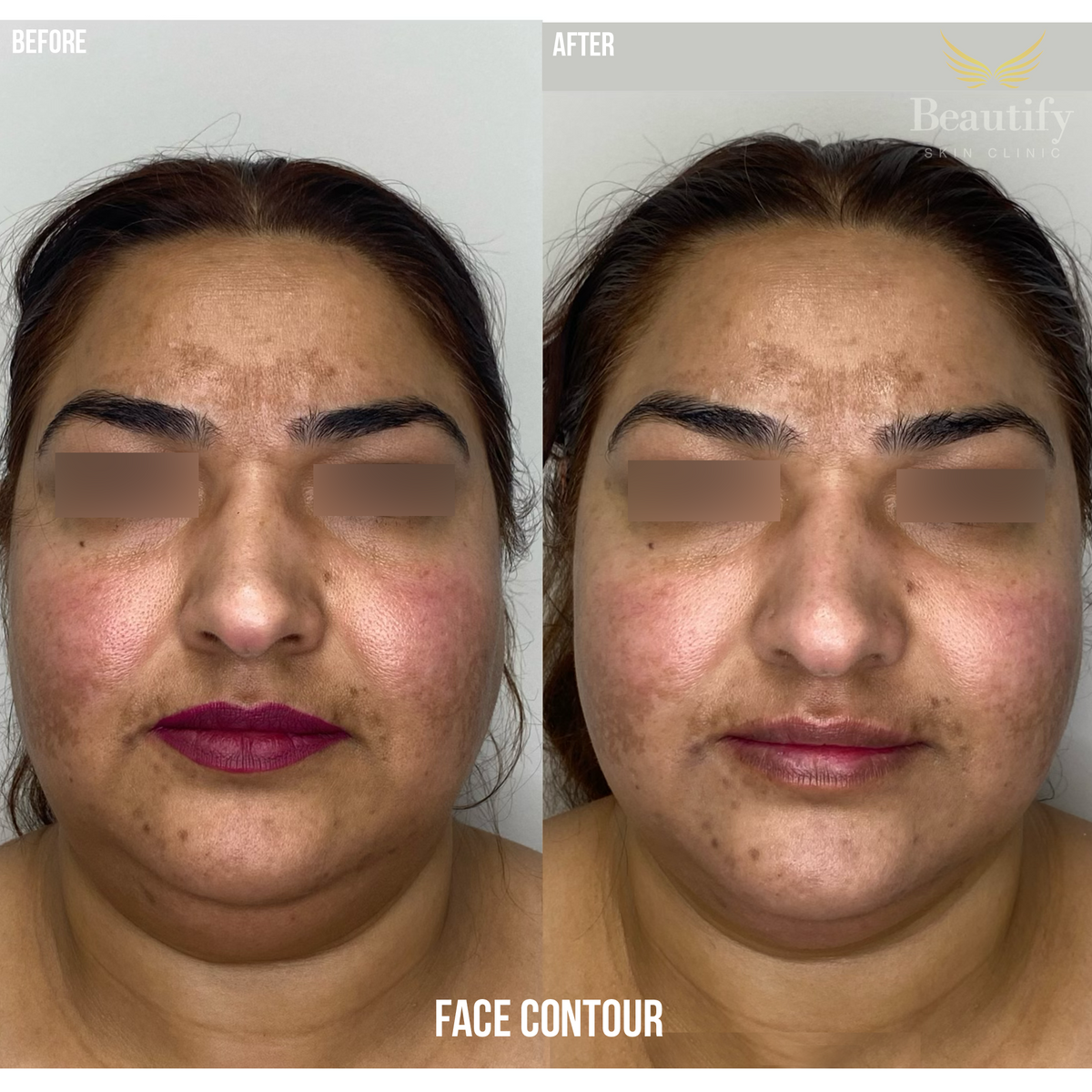 facecontour3.png