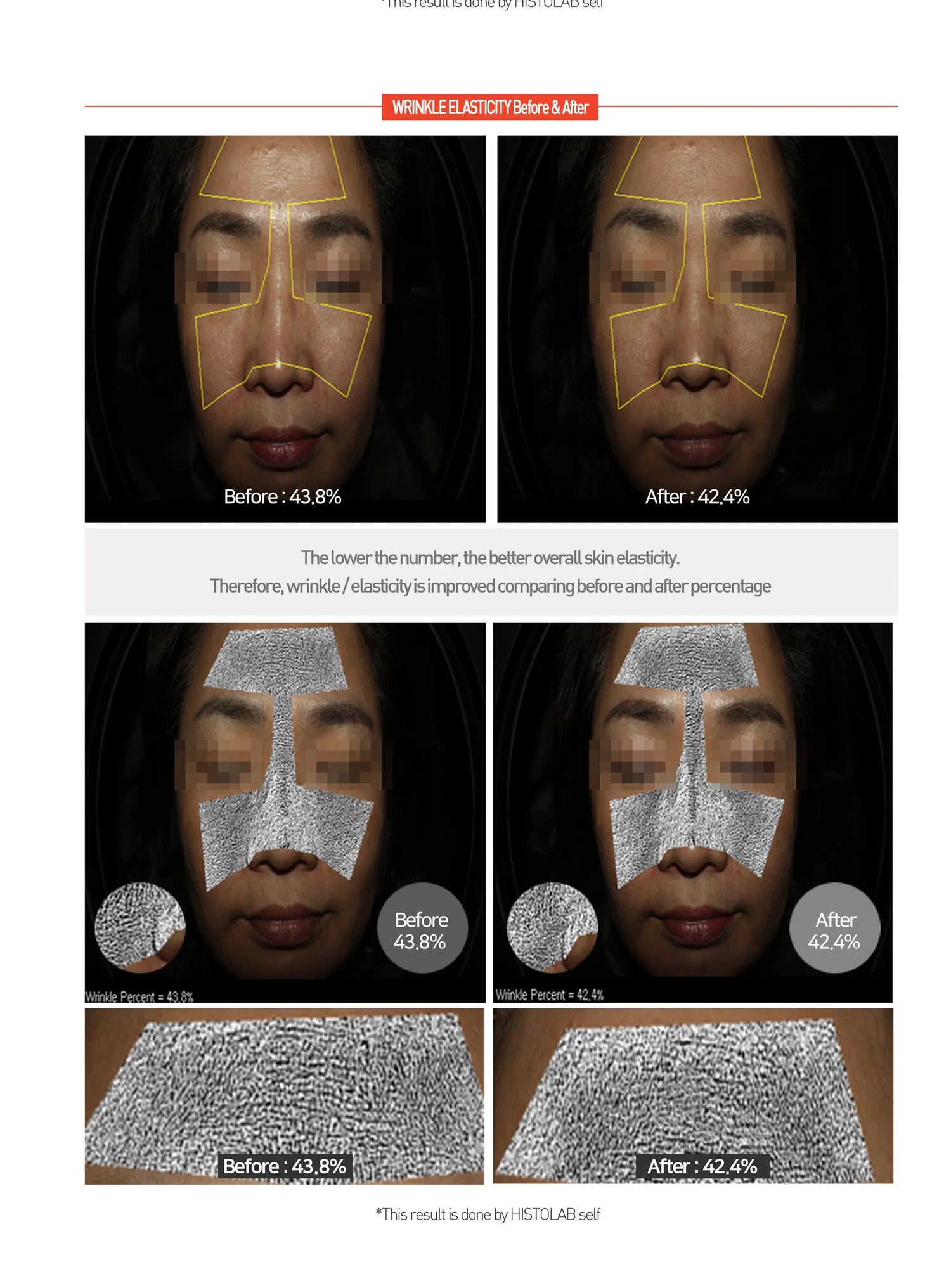 Hydrogel Regenerating Centella Cream (Sleeping Pack)